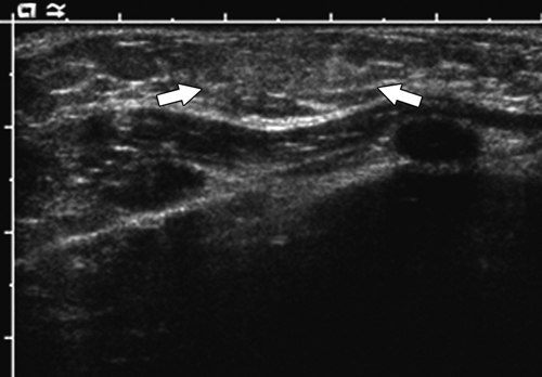 Fig-1a