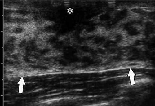 Fig-1c