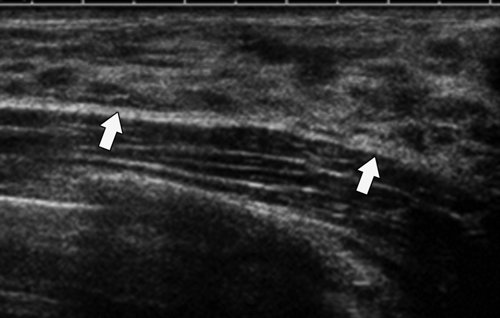 Fig-1e