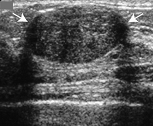 Fig-4