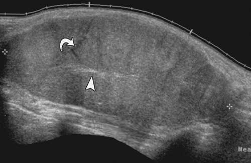 Fig-5