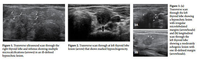 fig1pv 1404