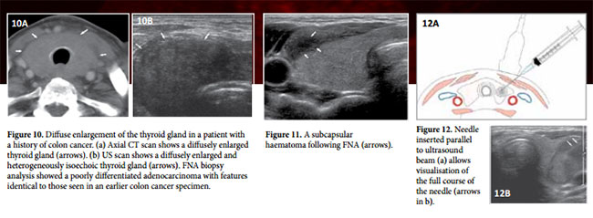 fig4pv 1404