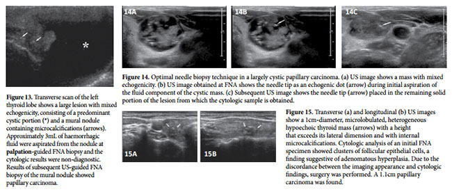 fig5pv 1404